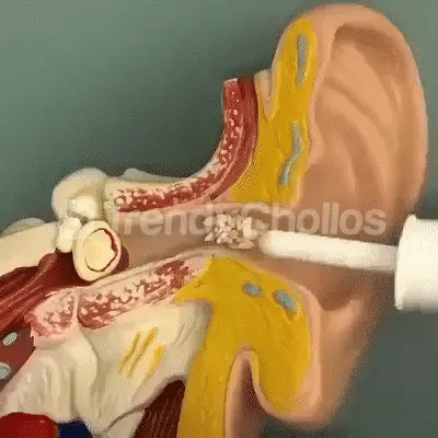 Aspirador de Cera CeraLimpio