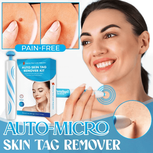 Auto Micro™ - Kit Removedor de Sinais de Pele IN 🇵🇹