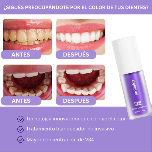 Sorriso Brilhante Instantâneo